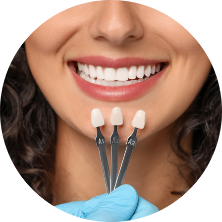 before & after procedure of teeth whitening in pittsburgh, pa